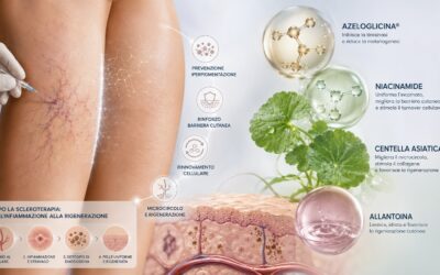 L’IMPIEGO DI NUOVI TRATTAMENTI TOPICI NELLA PREVENZIONE DELLA COMPARSA DI MACCHIE CUTANEE E DISCROMIE POST-SCLEROTERAPIA